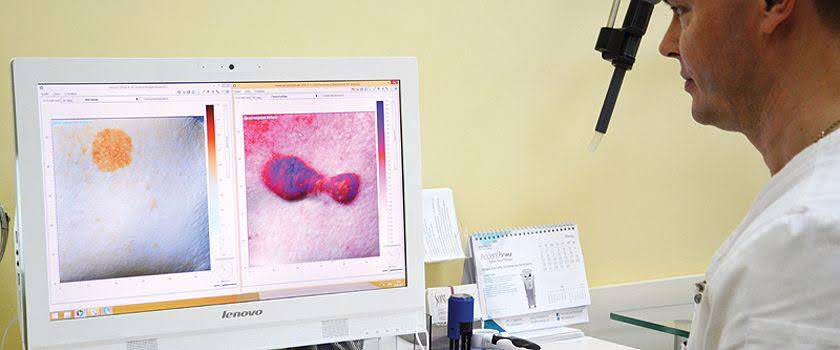 3D diagnostika kozhi 1