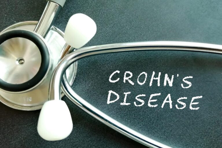What you Need to Know about Crohn’s Disease