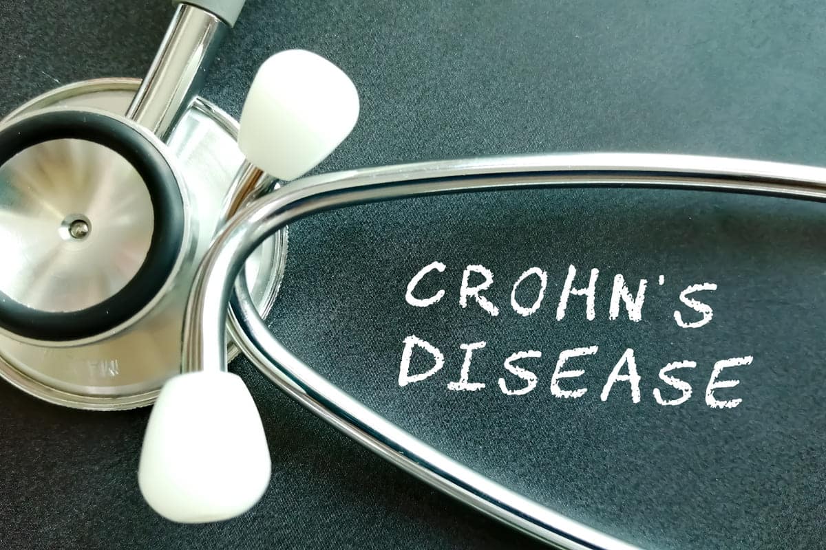 Crohns Disease feature