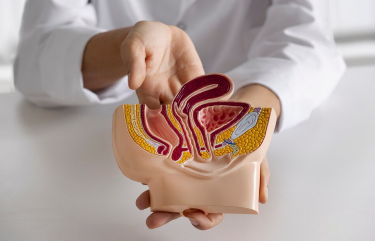 Hemorrhoids: An Ancient Ailment in Modern Times