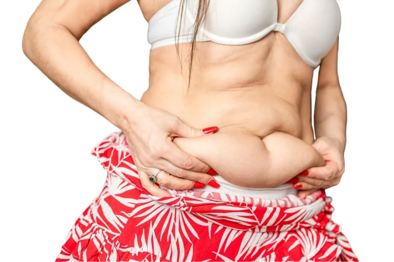 14 Ways to Tighten Skin After Weight Loss