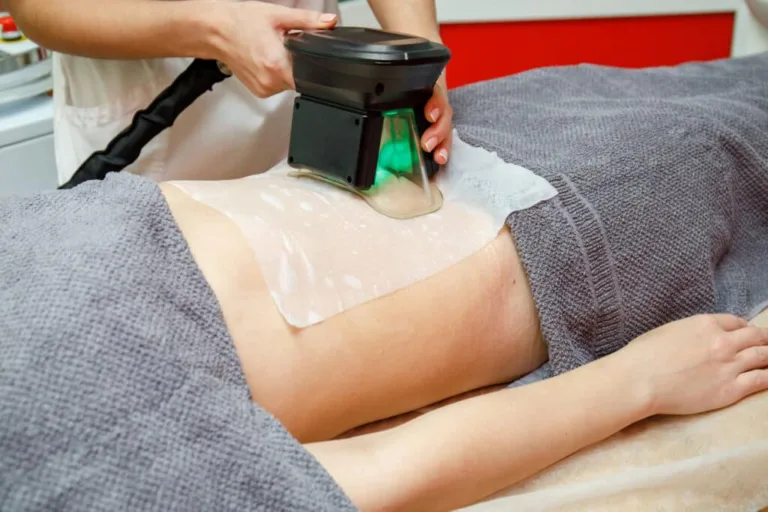 CoolSculpting Results: Does This Non-Surgical Fat Freezing Really Work?