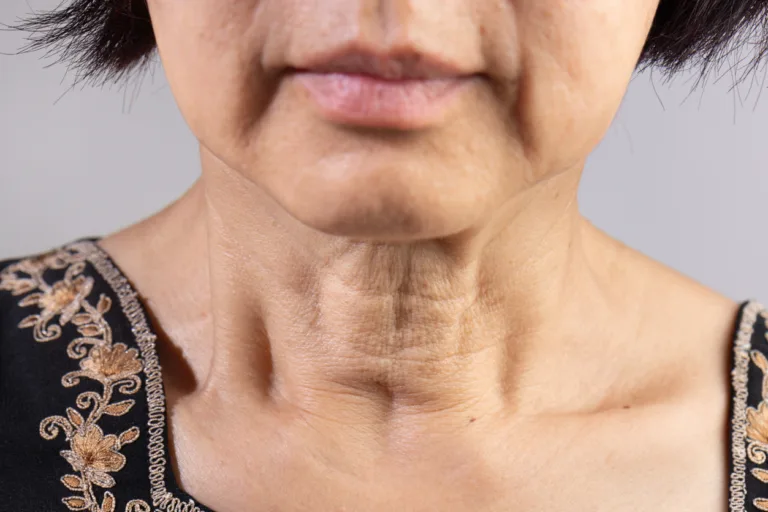 13 Best Crepey Skin Treatments to Restore Firmness & Smoothness in 2024
