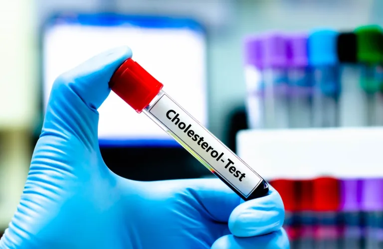 The Surprising Link Between Cholesterol and Dementia—And How Statins May Help