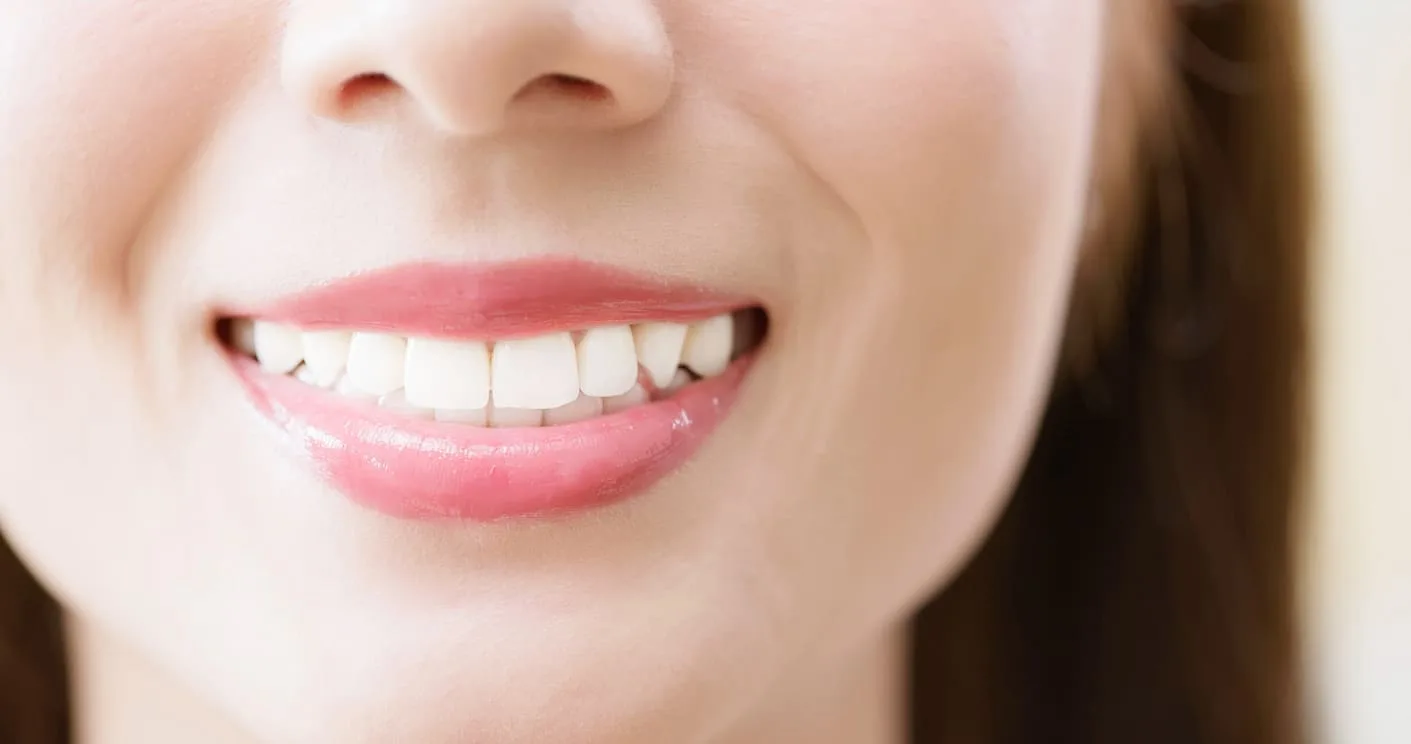 white teeth 1